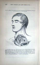 book, Anatomy of Arteries, John Hatch Power, 1863, fig.jpg (123485 bytes)